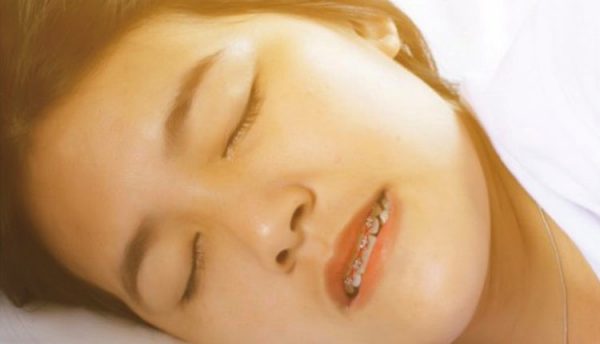 تاثیر دندان قروچه بر ارتودنسی