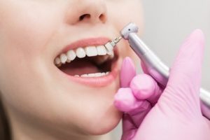 پولیش و پاکسازی دندان ها