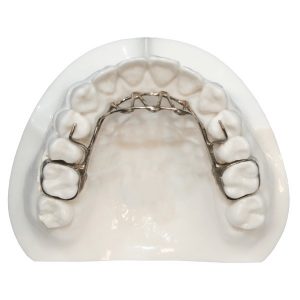 تانگ کریب در درمان ارتودنسی