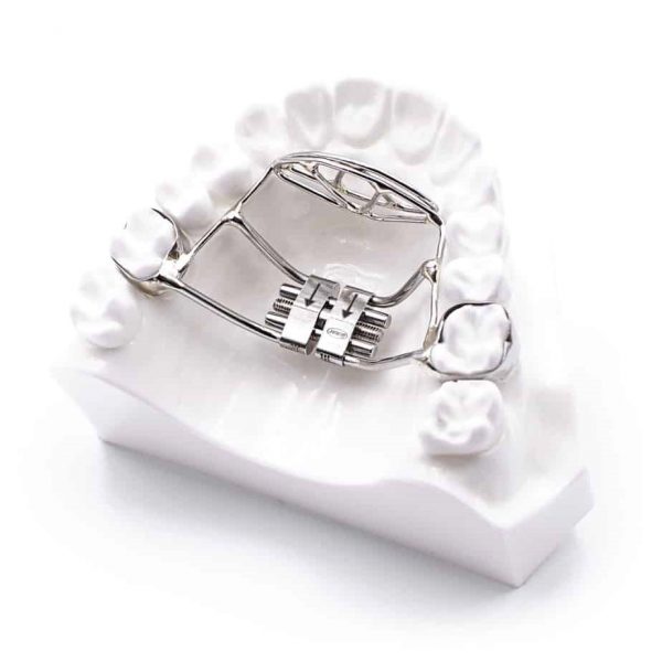 تانگ کریب در درمان ارتودنسی