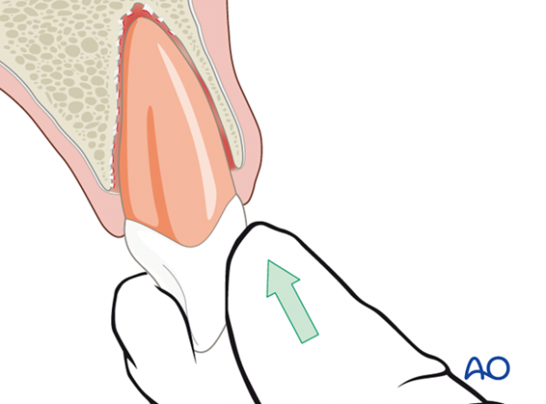موارد اورژانسی دندانپزشکی