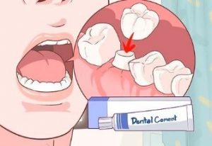 موارد اورژانسی دندانپزشکی