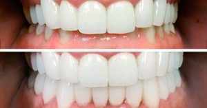 تشخیص مشکل بایت