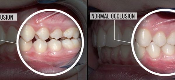 تشخیص مشکل بایت